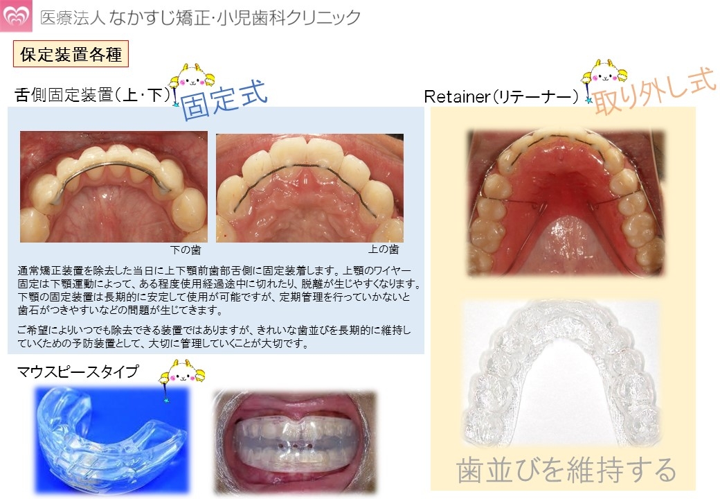 クーポン対象外】 歯科矯正治療の基礎 混合歯列期を中心に 健康・医学 